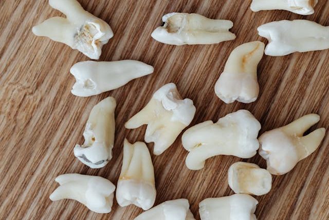 Why Choose Us for Root Canal Treatment in Orem, Utah?