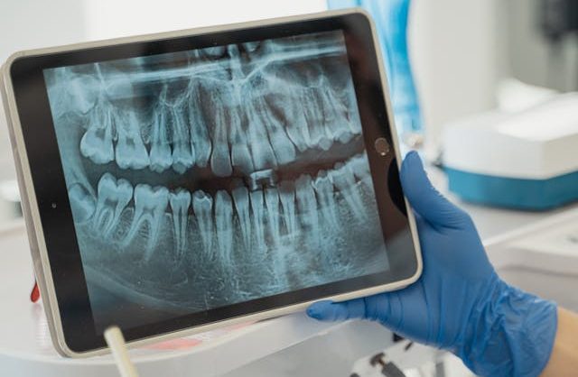 Choosing the Right Specialist for Your Root Canal in Orem
