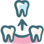 Dental Veneers