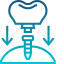 Dental Implant