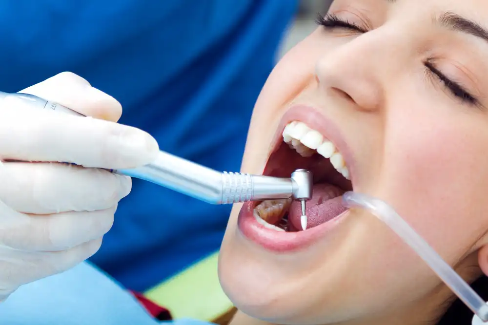 What Is a Sedative Filling