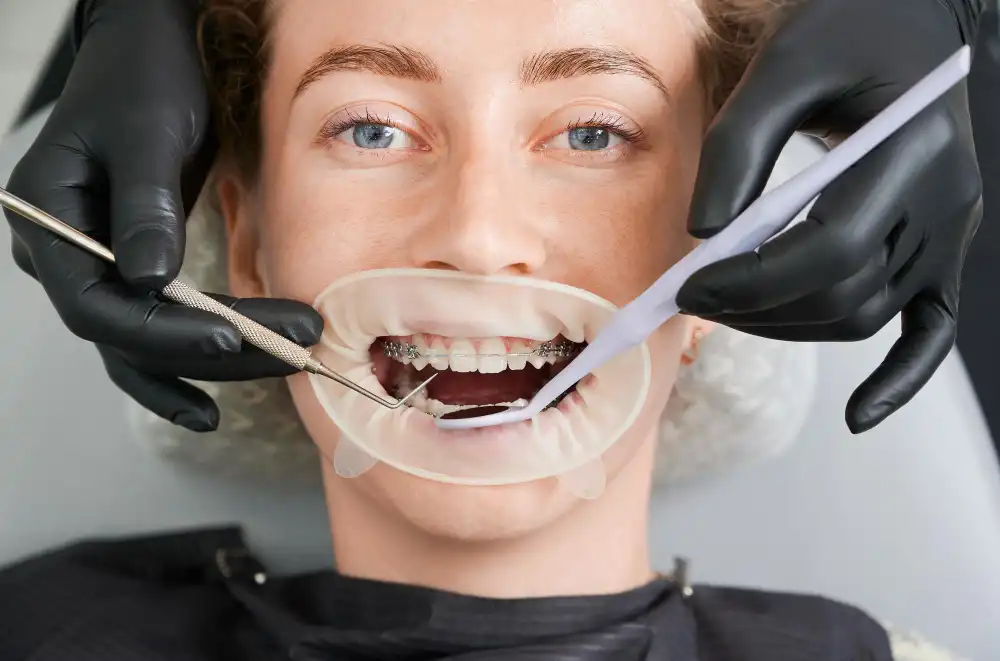 What Is Gum Contouring