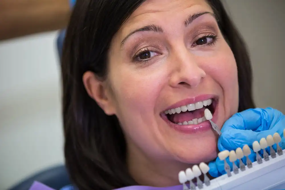 What Are Front Teeth Crowns