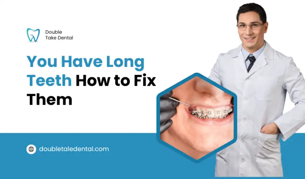 You Have Long Teeth and How to Fix Them