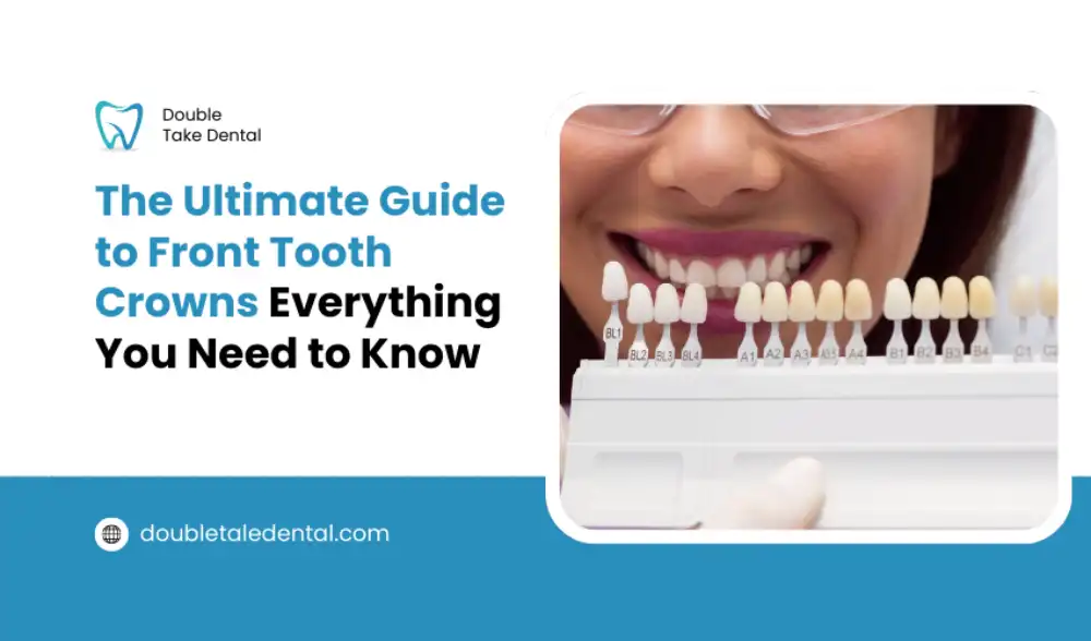 The Ultimate Guide to Front Tooth Crowns