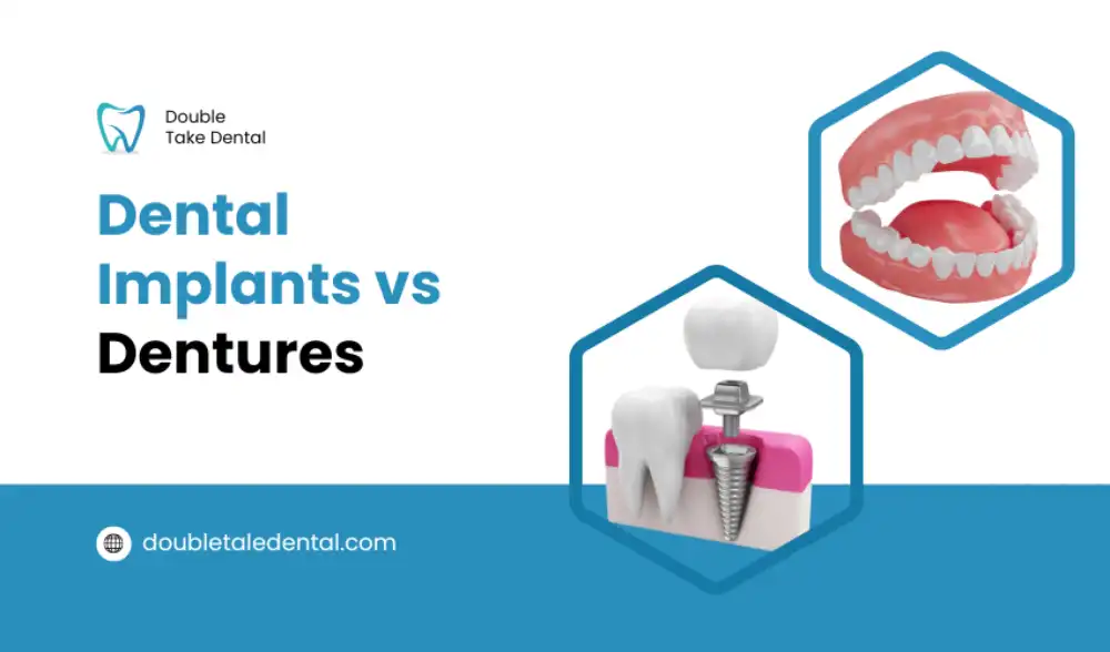 Dental Implants vs. Dentures In-Depth Comparison Guide