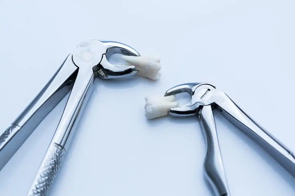 Tooth Extraction Healing Process
