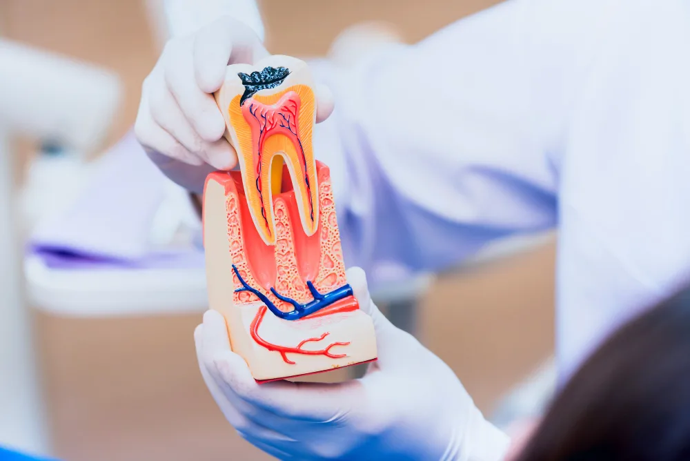Eating Guidelines After a Root Canal