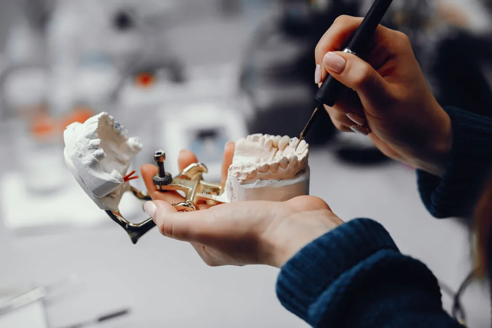 What Are Dental Implants