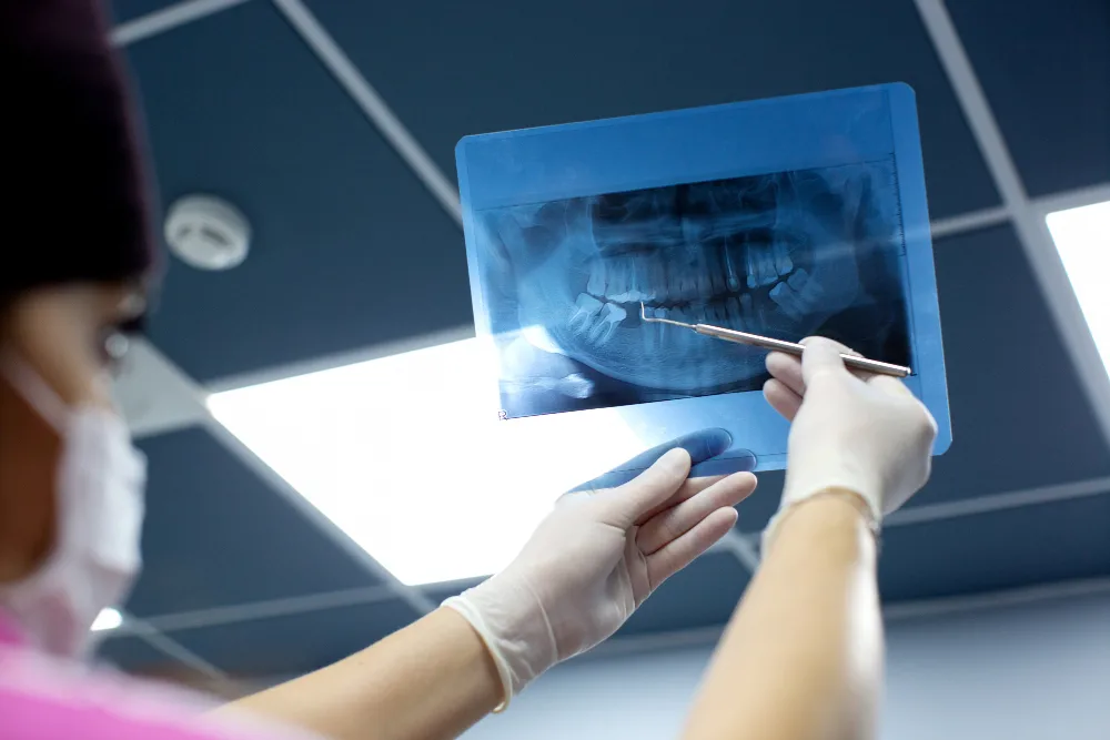 What Are Intraoral X-rays