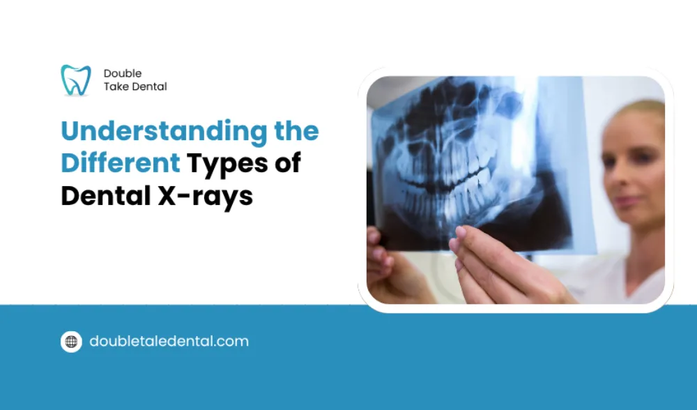 Different Types of Dental X-rays