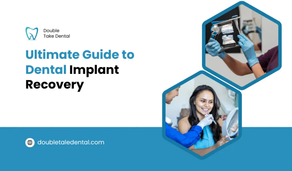 Ultimate Guide to Dental Implant Recovery
