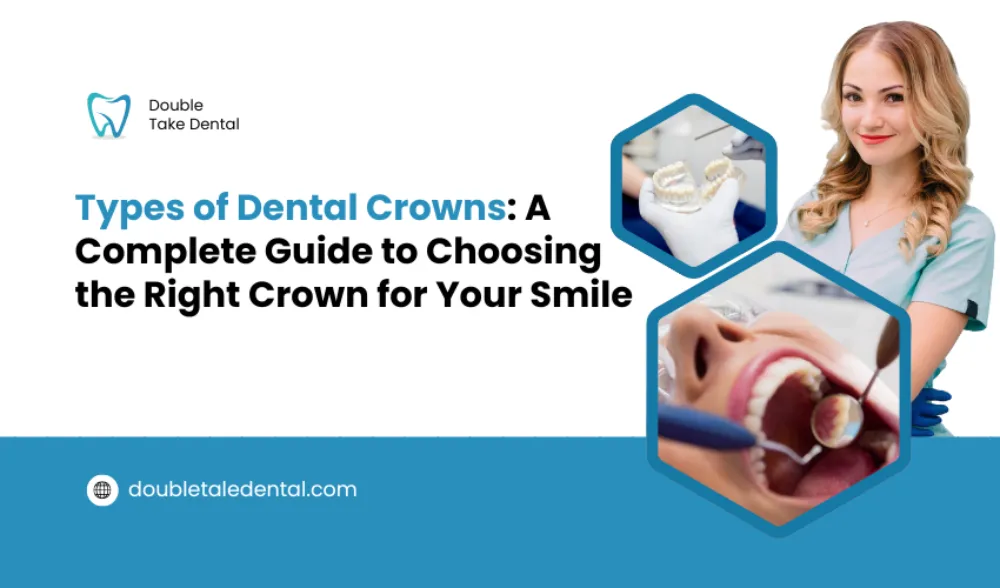 Types of Dental Crowns