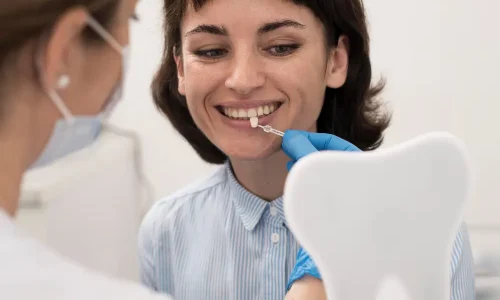 Dental Veneers