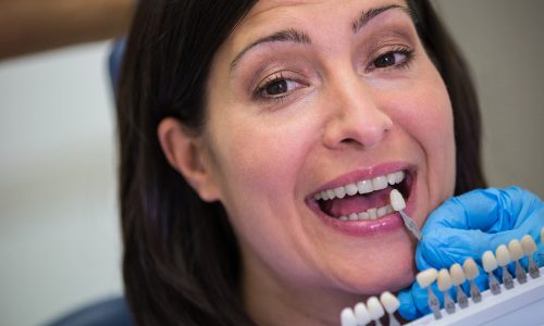 Dental Implants