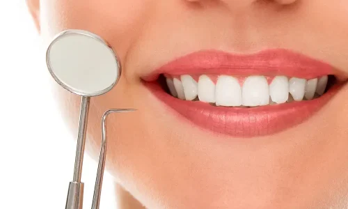 Dental Bonding